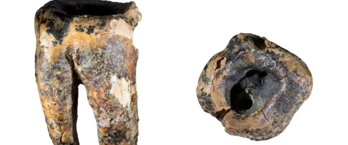 Neandertales trataban caries con piedras hace 60.000 años
