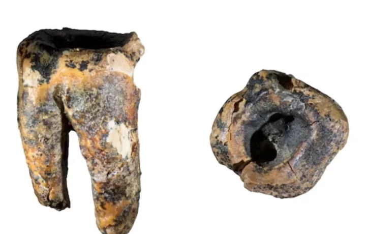 Neandertales trataban caries con piedras hace 60.000 años